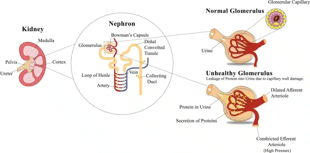 Diagram of MSC therapy mechanism for diabetic kidney disease — anti-fibrotic, anti-inflammatory, and podocyte-protective effects of mesenchymal stem cells in the glomerulus